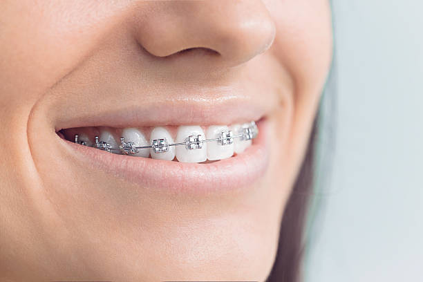 Best Dental Exams and Cleanings  in Mill Creek, WA